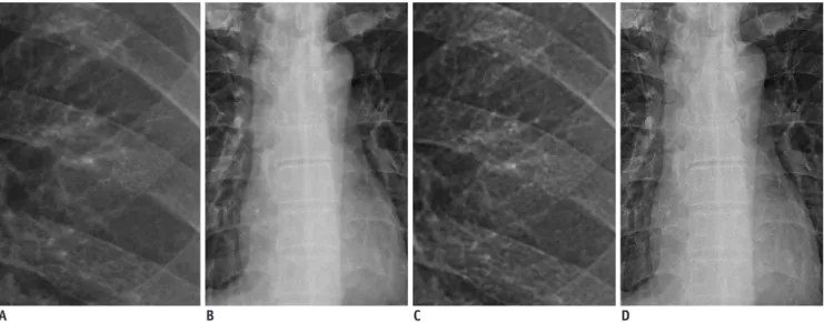 Fig. 4. 61-year-old man with non-small cell lung cancer. 