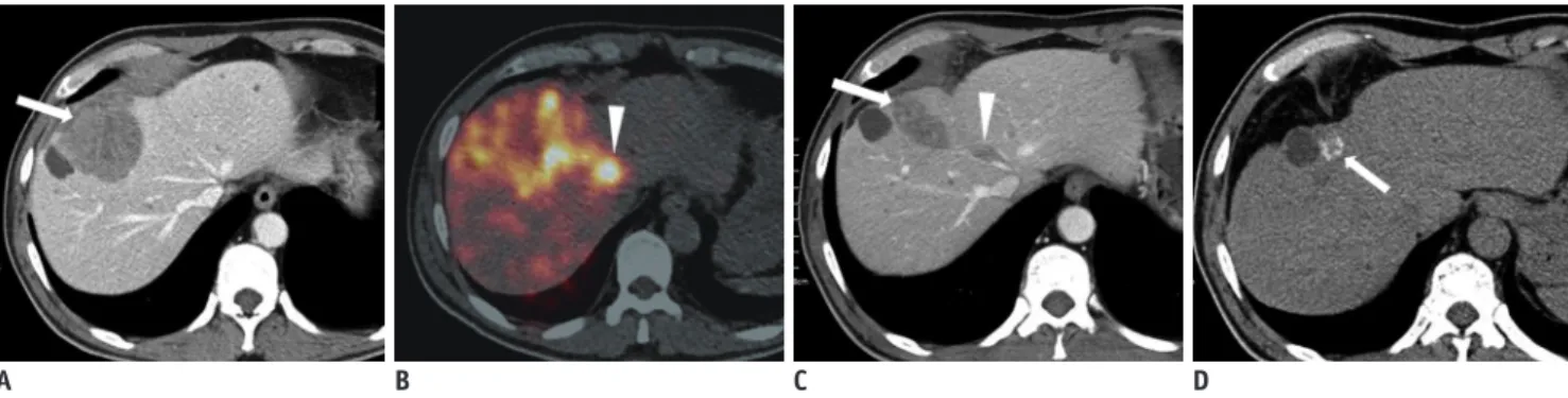 Fig. 10. 53-year-old man with HCC.
