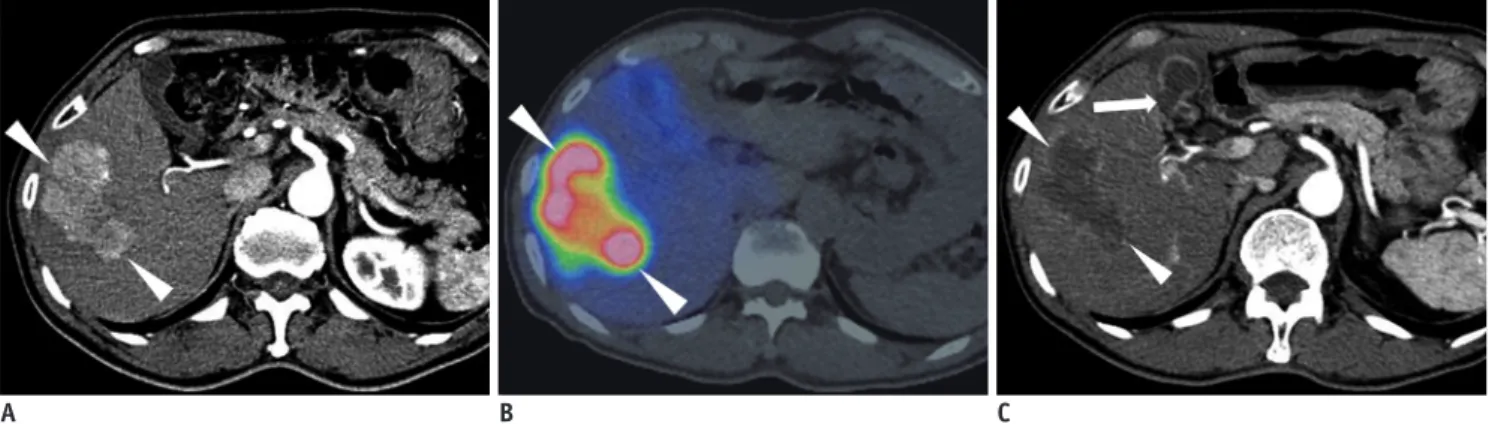 Fig. 1. 67-year-old man with HCC. 