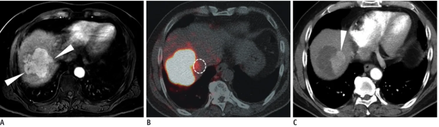 Fig. 2. 68-year-old man with HCC. 