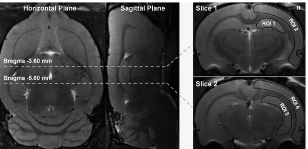 Fig. 1. ROI definition in right hippocampus and cortex of rats.  Hippocampus was defined at bregma -3.60 mm (ROI 1) and bregma -5.60  mm (ROI 3) on coronal T2WI