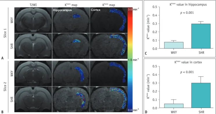 Fig. 2. BBB permeability increase in hippocampus and cortex of aged SHRs. 