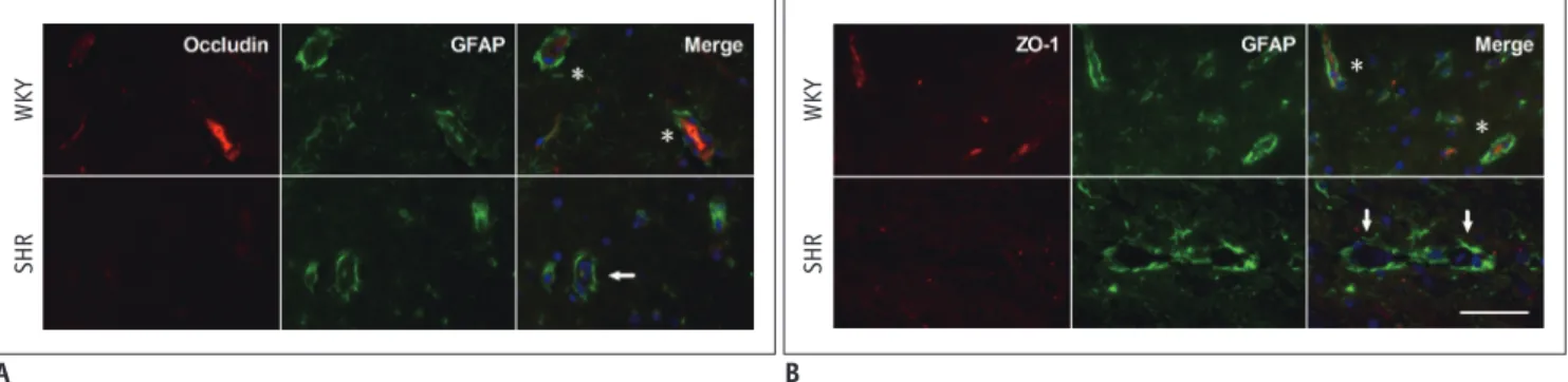 Fig. 3. Occludin and ZO-1 decrease in hippocampus of aged SHRs.