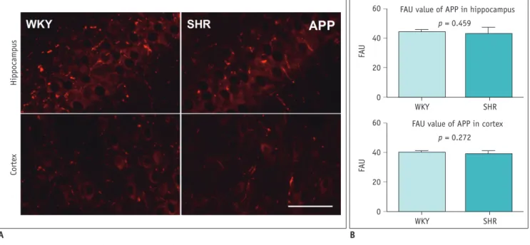 Fig. 6. APP expression in hippocampus and cortex of aged SHRs and age-matched WKY rats.