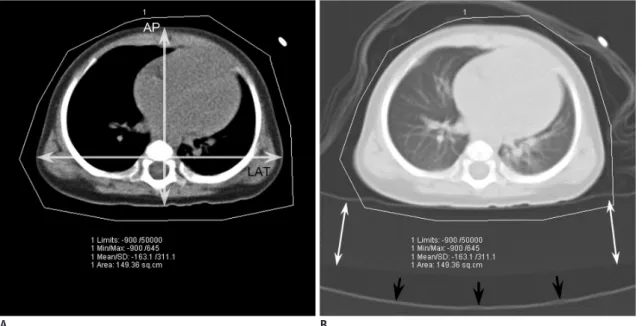 Fig. 1. Axial CT image obtained approximately 1−2 cm above dome of liver in which X-ray output in CTDI vol  based on 32-cm  phantom was individually determined