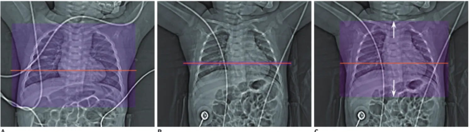 Fig. 2. Comparison of user-determined radiation dose in pediatric cardiothoracic CT with tube current modulation in two groups.