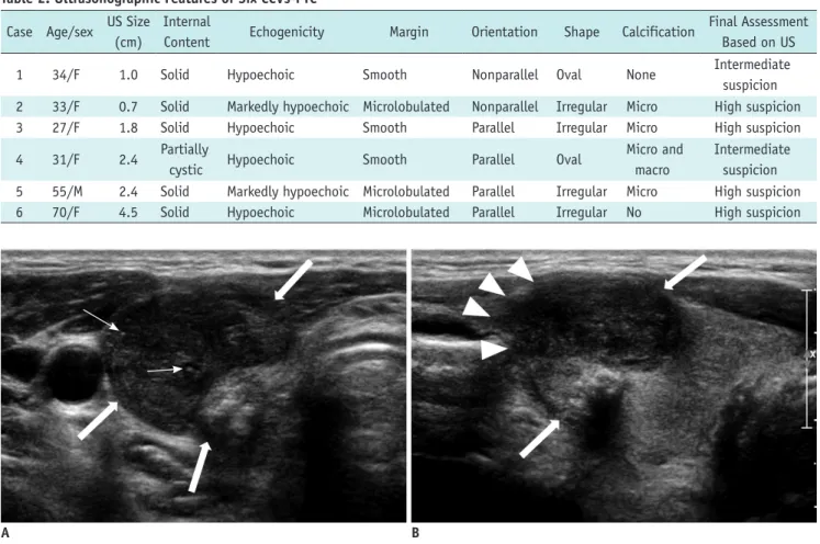 Fig. 2. Case 5: CCV-PTC in 55-year-old man. 