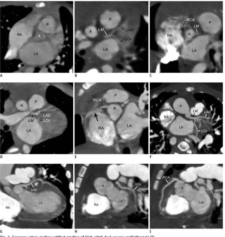 Fig. 3. Coronary artery motion artifact grading of high-pitch dual-source cardiothoracic CT