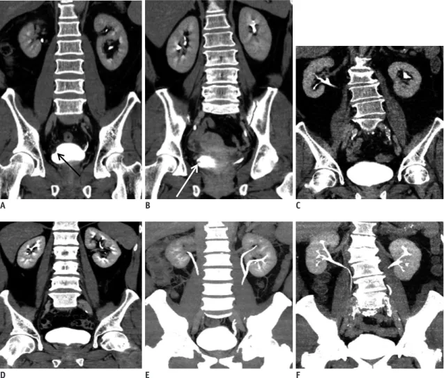 Fig. 5. Multi-planar reconstructed images of excretory phase in CTU. 