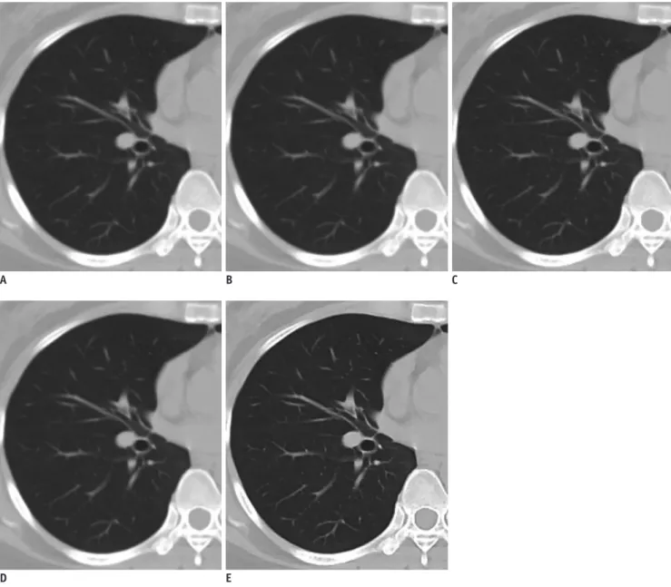 Fig. 1. Axial CT images of study population.