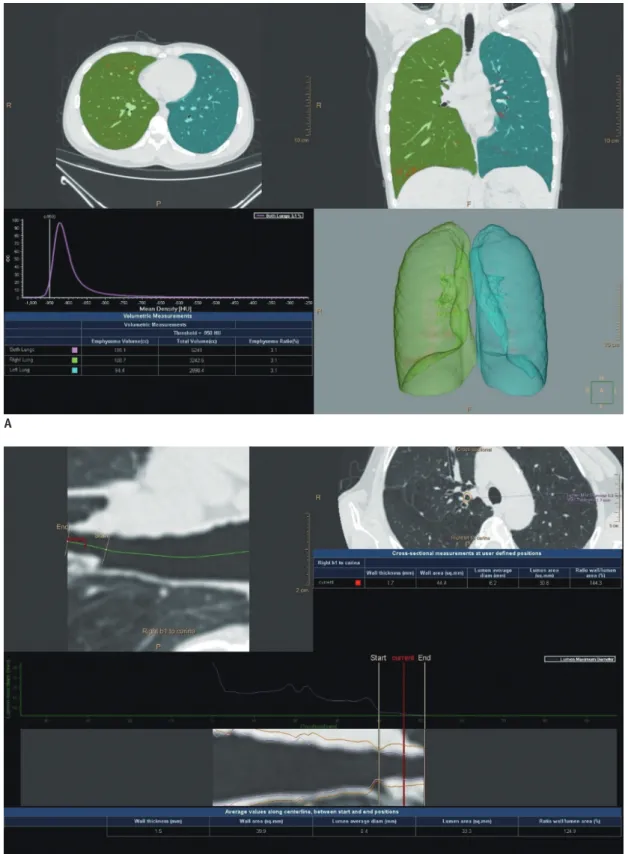 Fig. 2. Representative example of CT quantification of low lung attenuation area and airway from 64-year-old male