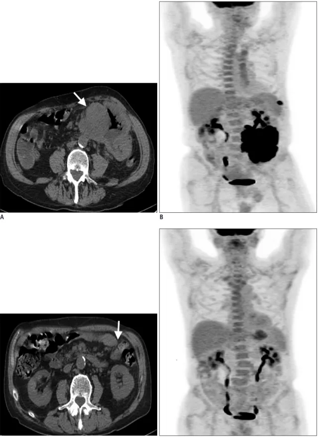 Fig. 5. 65-year-old man with HIV presented with progressive fatigue and abdominal pain