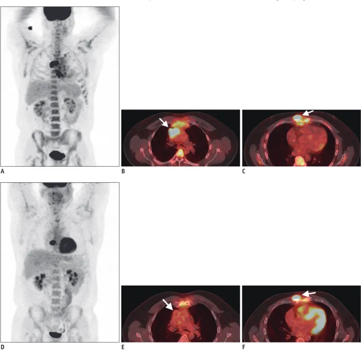Fig. 2. 43-year-old man with DLBCL. 