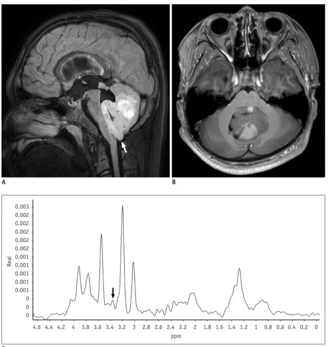 Fig. 7. 12-year-old boy with medulloblastoma. 