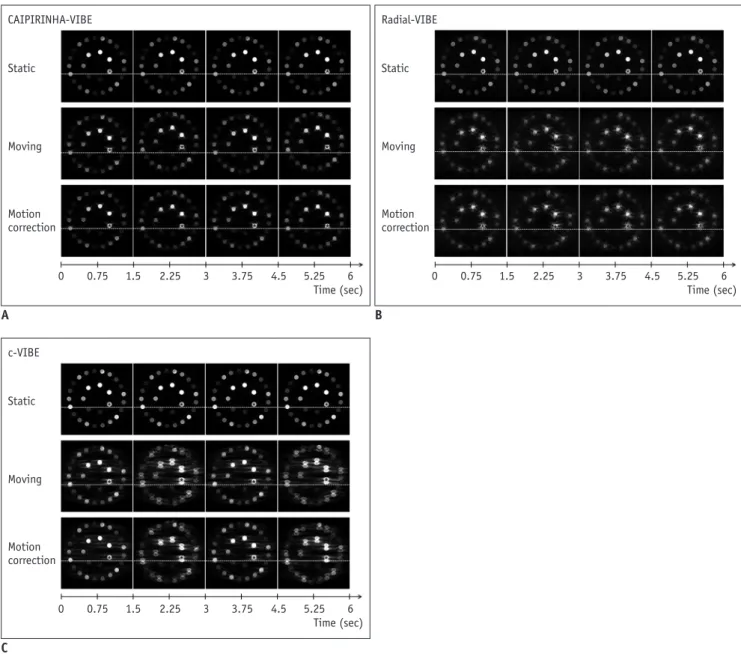 Fig. 2. Captured MRI images of dynamic scanning using each sequence according to motion mode