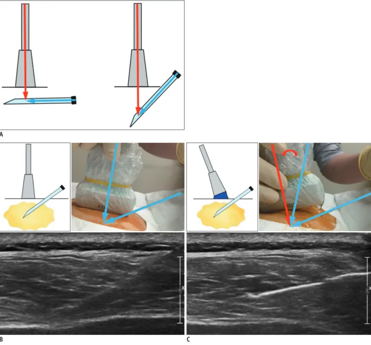 Fig. 8. Conceptual diagram for ultrasonographic visualization of biopsy needle.
