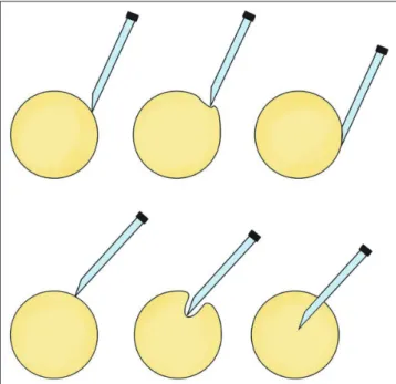 Fig. 10. 56-year-old female patient with soft-tissue mass in her left knee. 