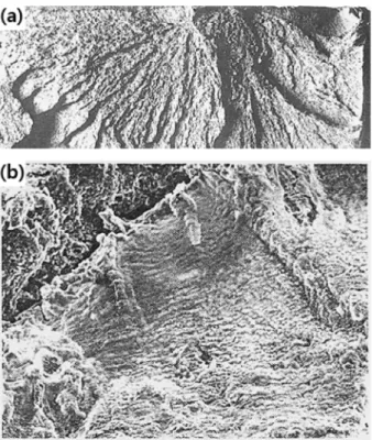 Fig. 14. Analysis of the direction of crack propagation using waveform ; (a) valve seat, (b) scroll, (c) nozzle area.