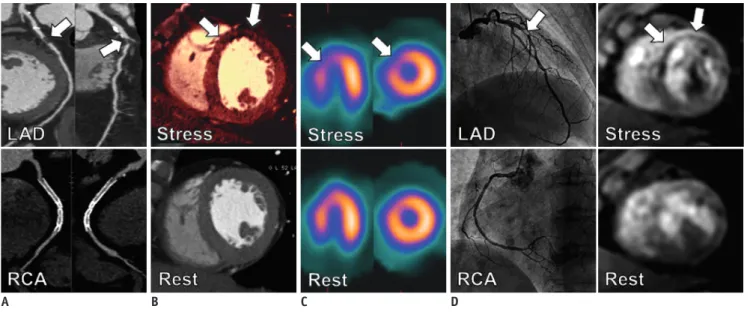 Fig. 1. Comparison of different imaging modalities for diagnosis of coronary artery disease.