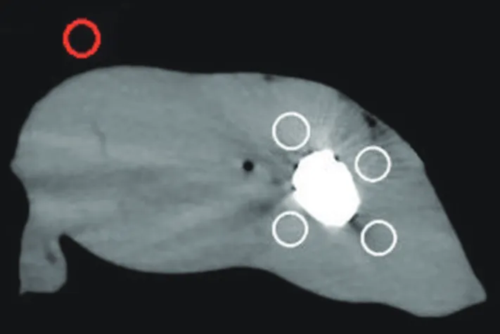 Fig. 3. Schematic of ROIs selection.  Four white circles showed  ROIs drawn in muscular area around metal implants