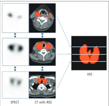 Fig. 1. Acquisition of thyroidal 3-dimensional VOI from  multiple 2-dimensional ROIs.  On transaxial CT images, ROIs were  manually drawn along contour of thyroid