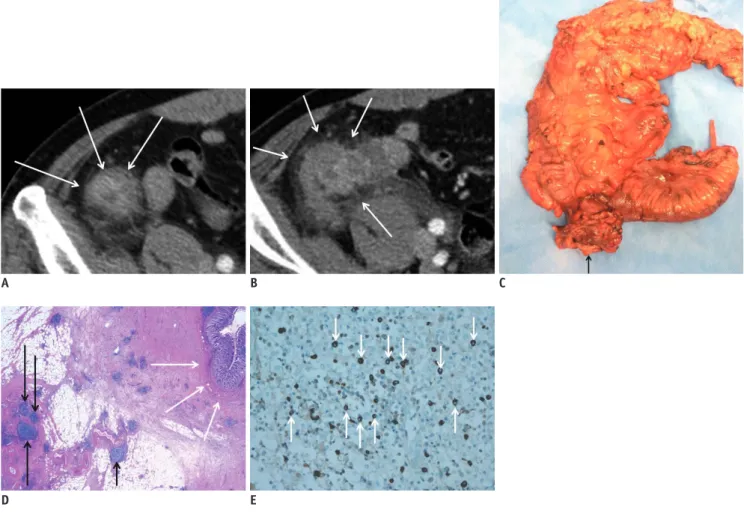 Fig. 1. Immunoglobulin G4-related disease in 51-year-old man.