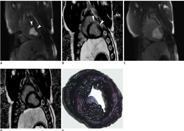 Fig. 2. Examples of MR perfusion, DE-MRI, and NBT staining in one animal. 