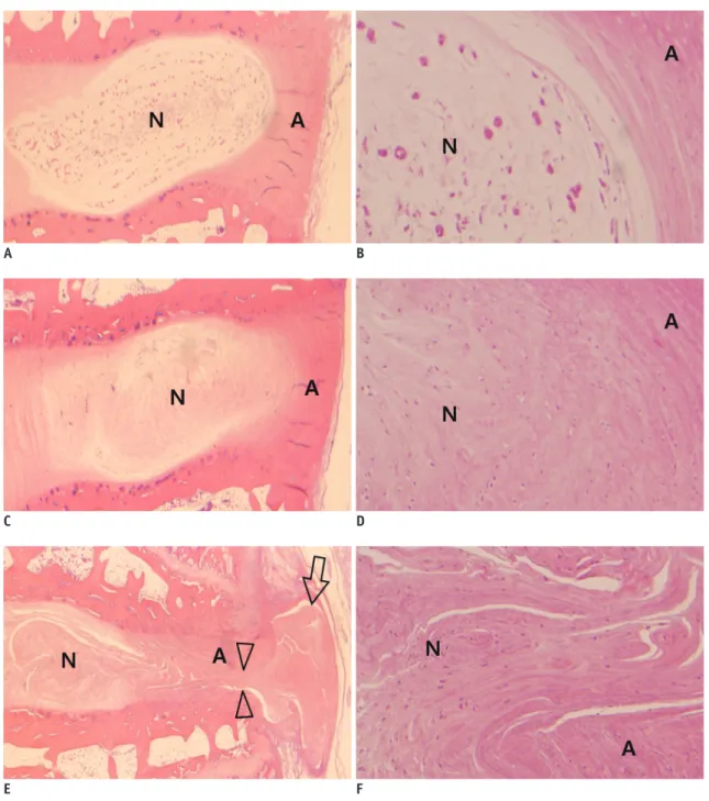 Fig. 3. Typical histologic grades of disc degeneration. 