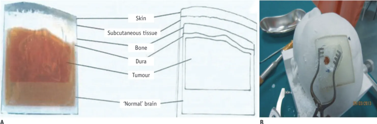 Fig. 15. Neurosurgical phantoms with pathological entity.