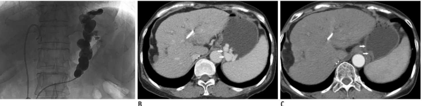 Table 2. Laboratory Data of Hepatic and Renal Function Test before and after BRTO