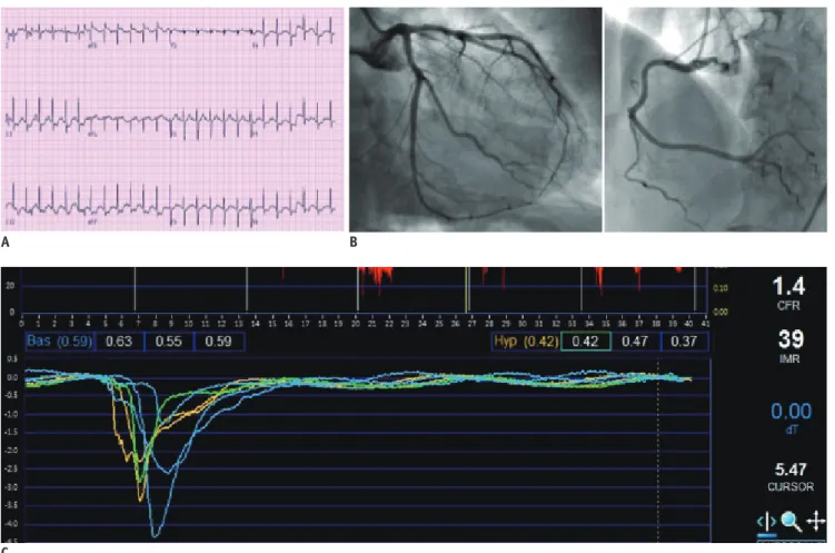 Fig. 7. Case example of microvascular disease. 