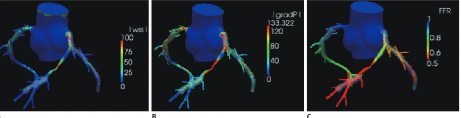Table 2 summarizes the previous studies that evaluate  the clinical relevance of FFR CT  technology