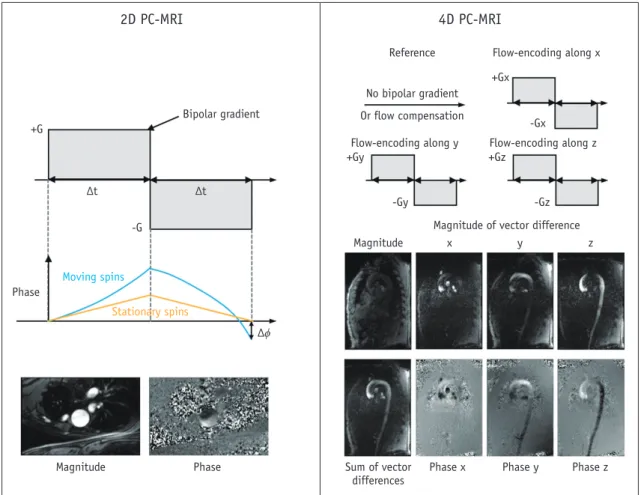 Fig. 1. Principles of 2D PC-MRI and 4D PC-MRI.  Conventional PC-MRI uses bipolar gradient along flow-encoding direction before readout  sequence