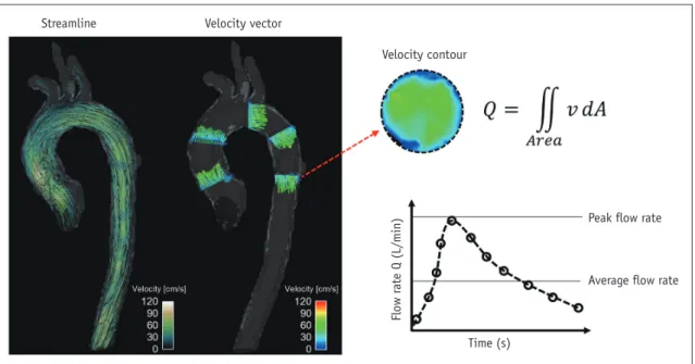 Fig. 3. Velocity visualization and quantification of flow rate.  Streamline and velocity vector (left panel) can be used to visualize blood  flow pattern in aorta