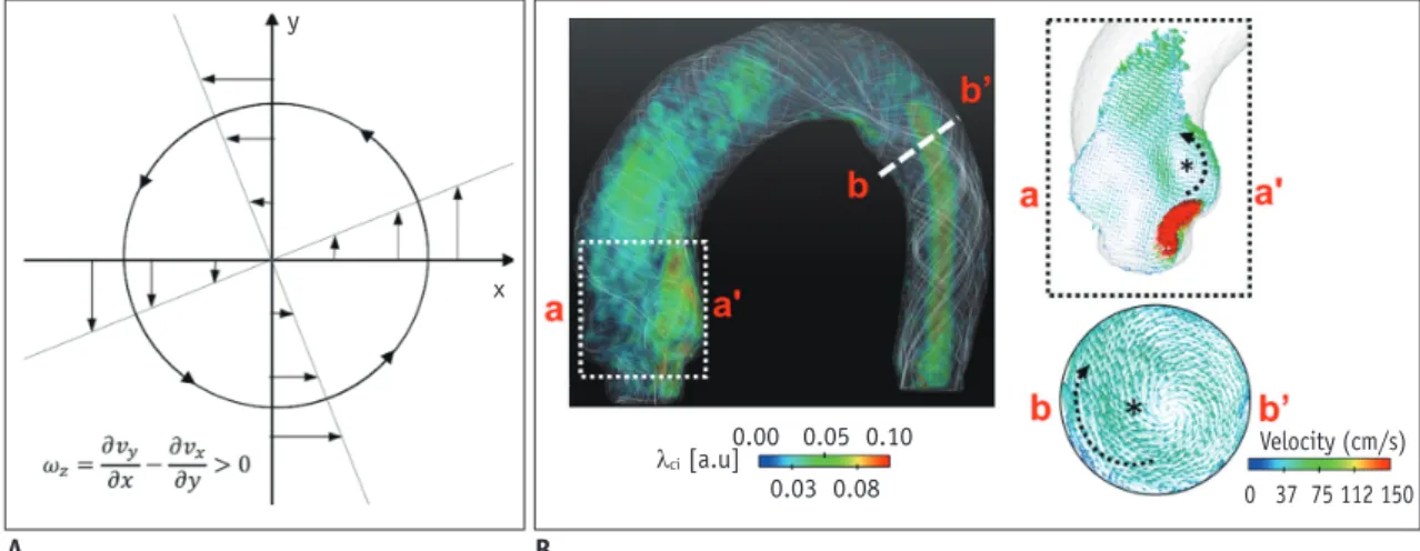 Fig. 6. Identification of vortical flow pattern.