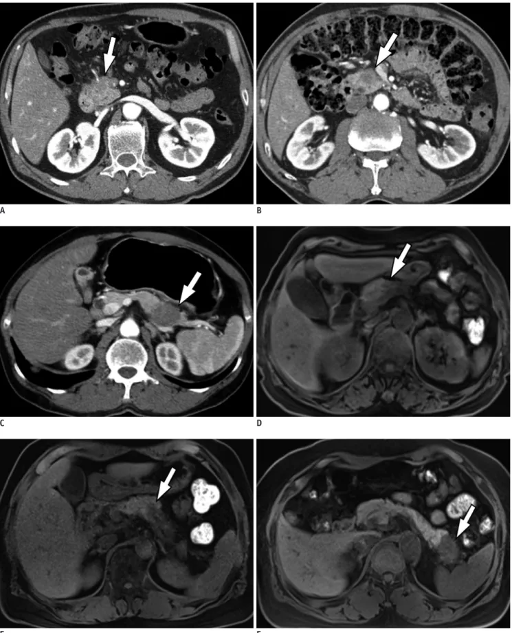 Fig. 2. Representative figures for each conspicuity category from six different patients with pancreatic ductal adenocarcinoma
