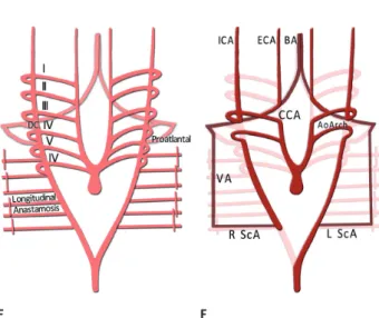 Fig. 1. Schematic illustration aortic arch system. 