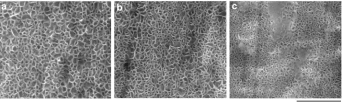 Fig. 8.  SEM images showing corrosion surface products of Mg-8%Al-X%Zn alloys obtained after 12 hrs of immersion in 1M NaCl solution : (a) 0%Zn, (b) 0.5%Zn and (c) 1.0%Zn.
