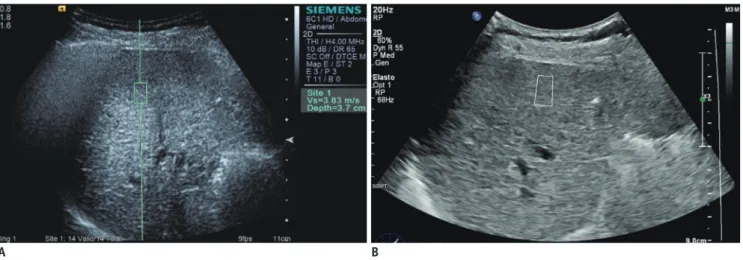 Fig. 1. Flow diagram of study population.  *One patient who had technical failure on VTQ also had unreliable measurement on ElastPQ
