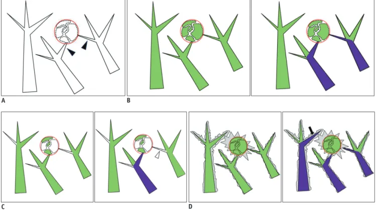 Fig. 1. Segmentation sensitivity step.