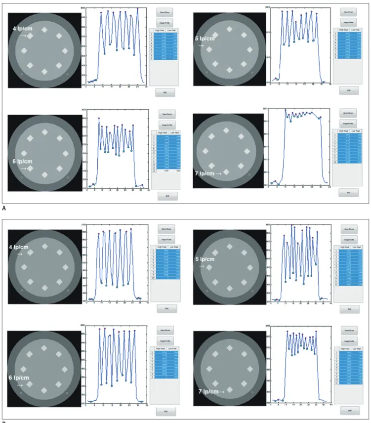 Fig. 1. Example results of phantom study with model-based iterative reconstruction (MBIR) are shown (A, scanned under 120  kVp, 10 mA); B (120 kVp, 50 mA)