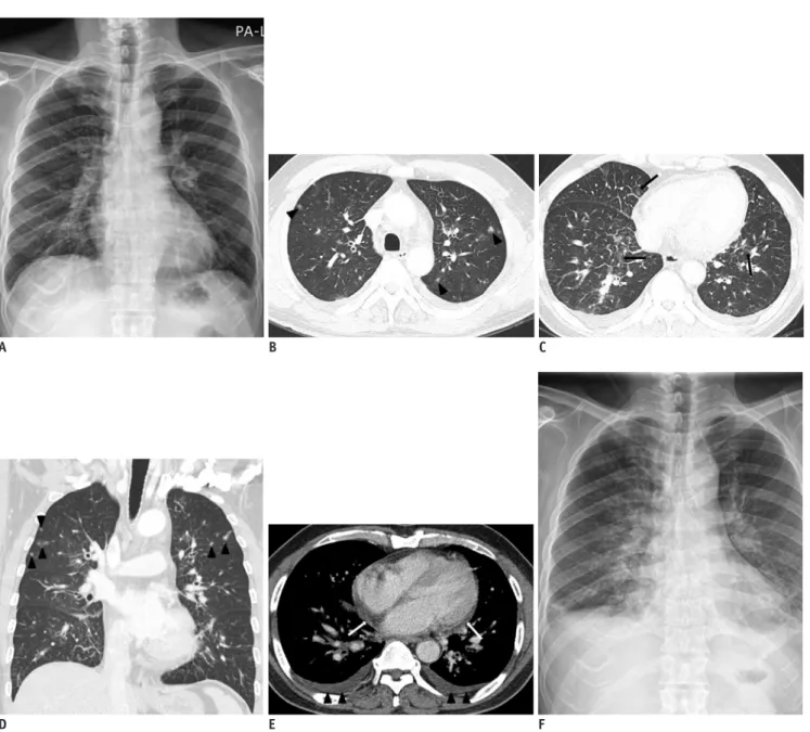Fig. 1. 56-year-old man presented with 4-day history of febrile sensation. 