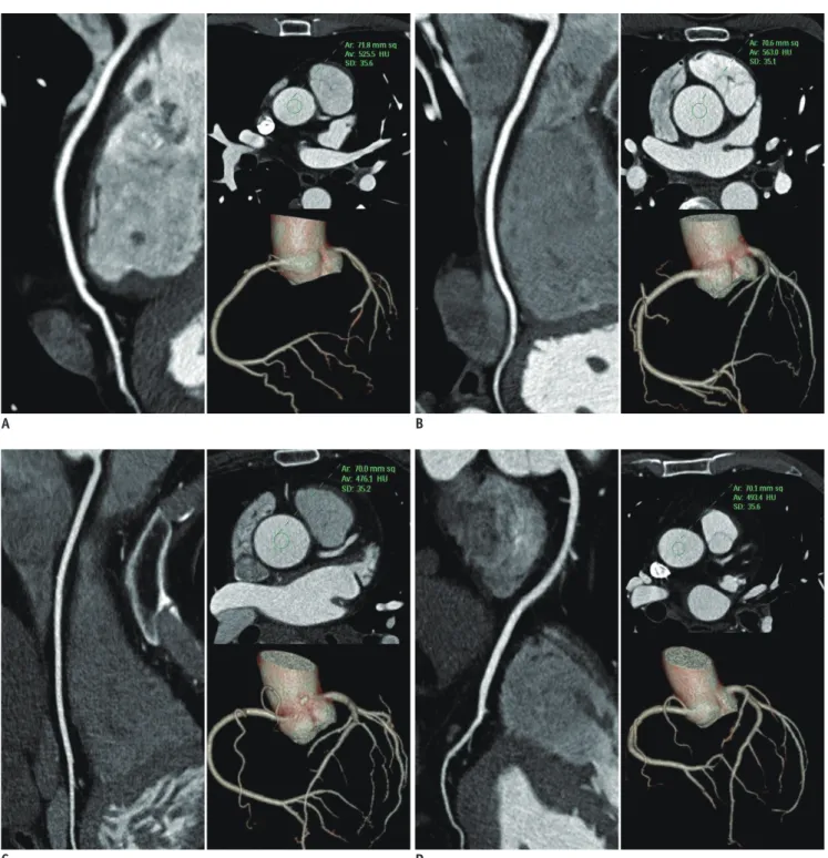 Fig. 2. Curved-planar reconstruction of right coronary artery and volume-rendered trees demonstrating image quality of four CCTA  protocols.