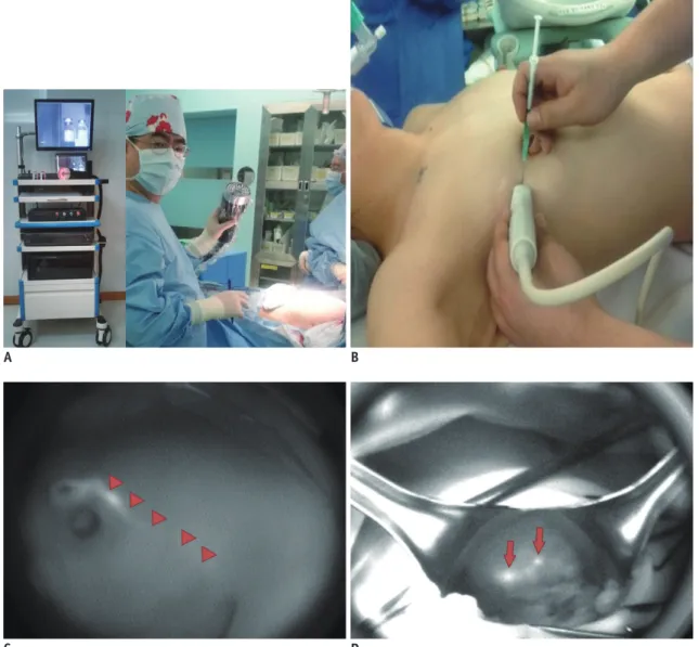 Fig. 2. Various types of fluorescence imagers can be applied to visualize tissues stained with indocyanine green (ICG) in clinical  applications.