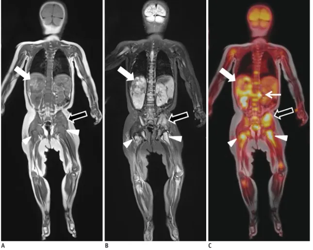 Fig. 8. One-year-old male with neuroblastoma. 