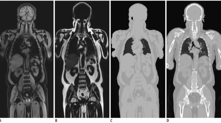 Fig. 1. Dixon MRI-based attenuation correction. 