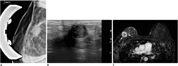 Fig. 1. 41-year-old woman who had undergone right partial mastectomy due to invasive ductal carcinoma