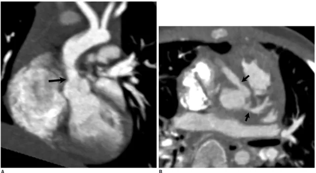 Fig. 9. 10-month-old boy with Williams syndrome.