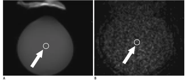 Fig. 3. SNR measurement.