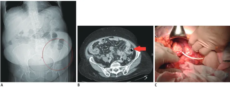 Fig. 1. First patient.